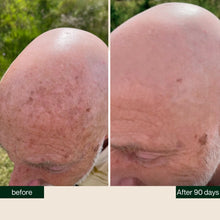 Laden Sie das Bild in den Galerie-Viewer, BETTER BE BOLD - Anti-Pigment Glatzenserum